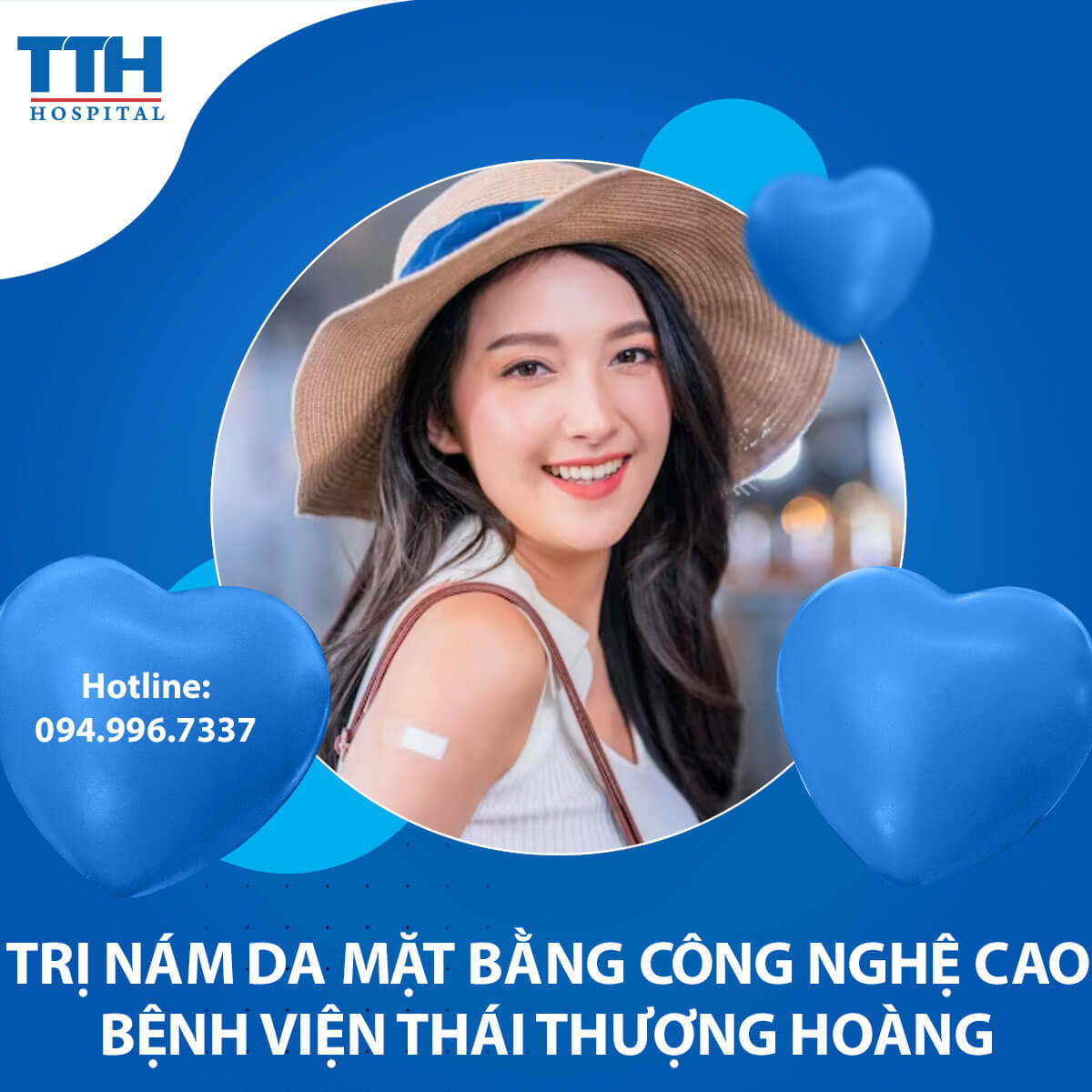 Trị Nám Da Mặt Bằng Công Nghệ Cao tại Vinh, Nghệ An
