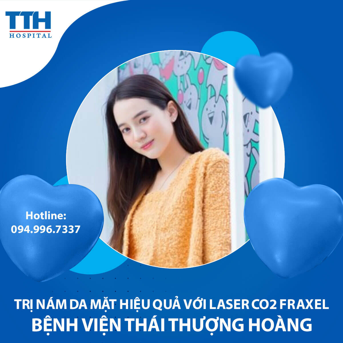 Trị Nám Da Mặt Hiệu Quả Với Công Nghệ Laser CO2 Fraxel