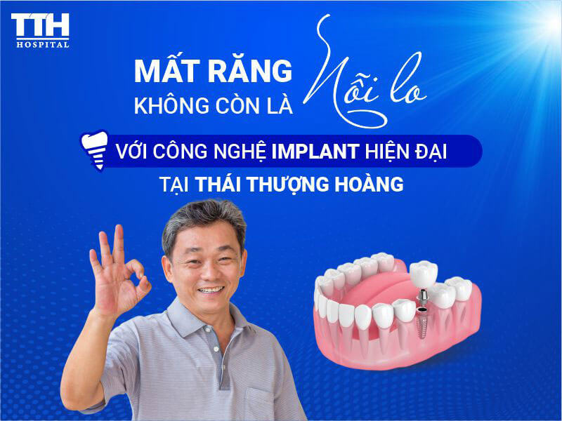 Trồng Răng Implant Thời Nay – Không Còn Là Nỗi Lo!