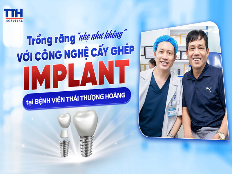 Trồng răng “nhẹ như không” với công nghệ cấy ghép Implant