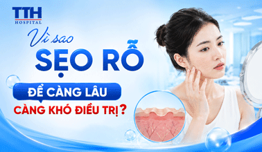 VÌ SAO SẸO RỖ ĐỂ CÀNG LÂU CÀNG KHÓ ĐIỀU TRỊ?