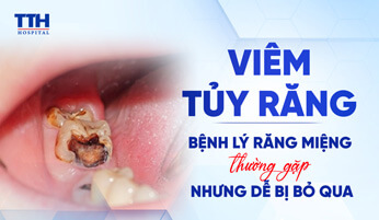 Viêm tủy răng – Bệnh lý răng miệng thường gặp nhưng dễ bị bỏ qua