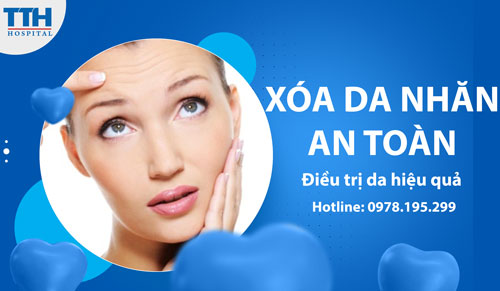 Xóa da nhăn an toàn - Điều trị da hiệu quả và tự tin hơn